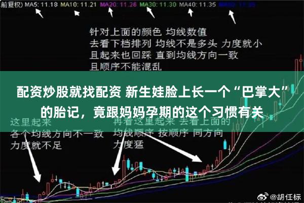 配资炒股就找配资 新生娃脸上长一个“巴掌大”的胎记，竟跟妈妈孕期的这个习惯有关